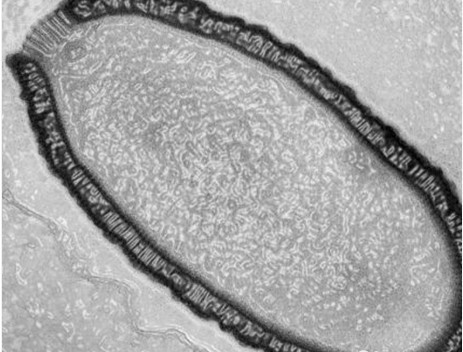 巨型病毒阔口|痮?Pithovirus sibericum)