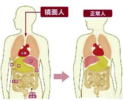 镜面Z件_镜面人Ş成的原因